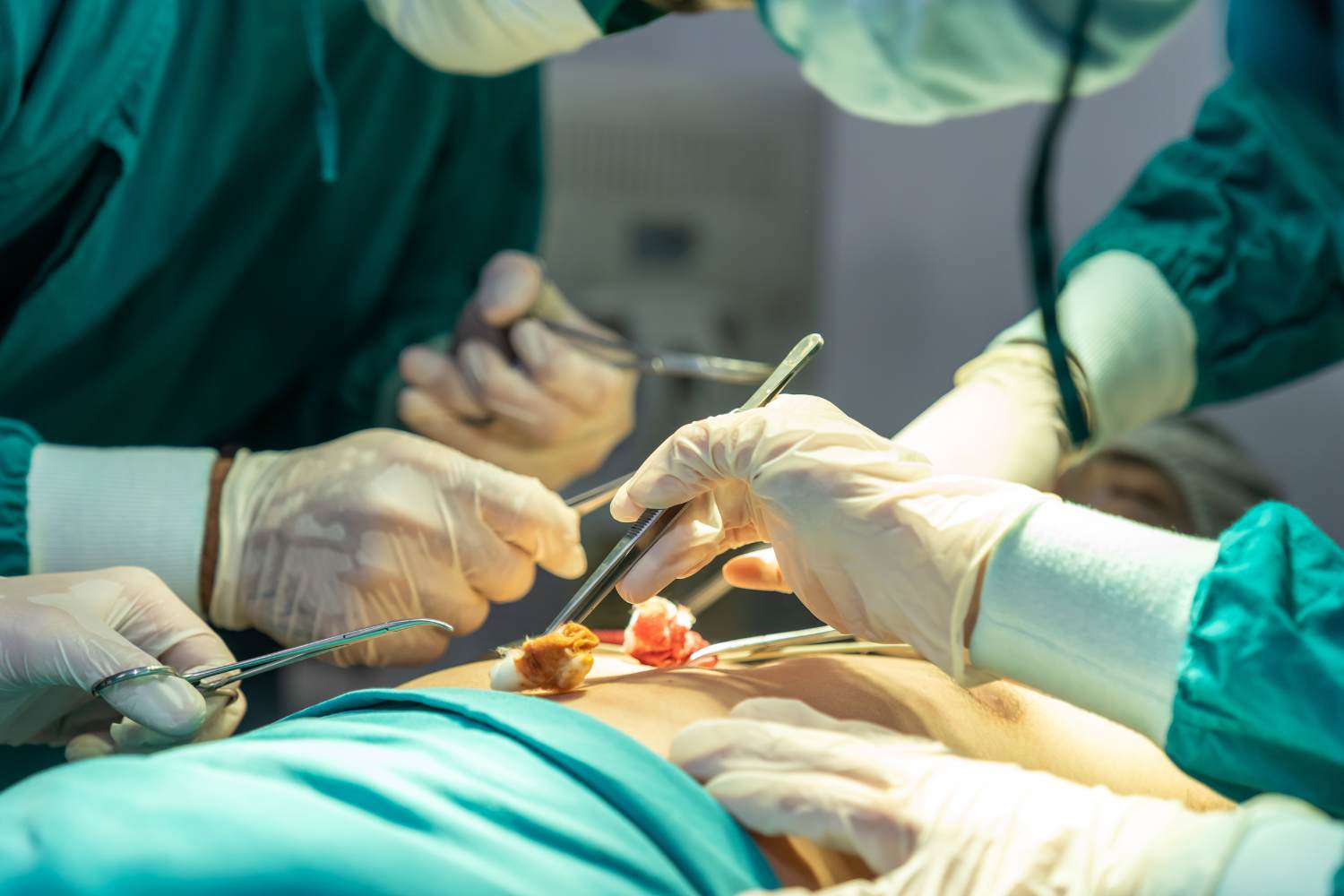 Is Endoscopy Painful? Myths vs Facts Explained by Experts