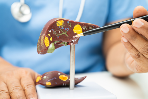 Gallbladder & Bile Duct Stones